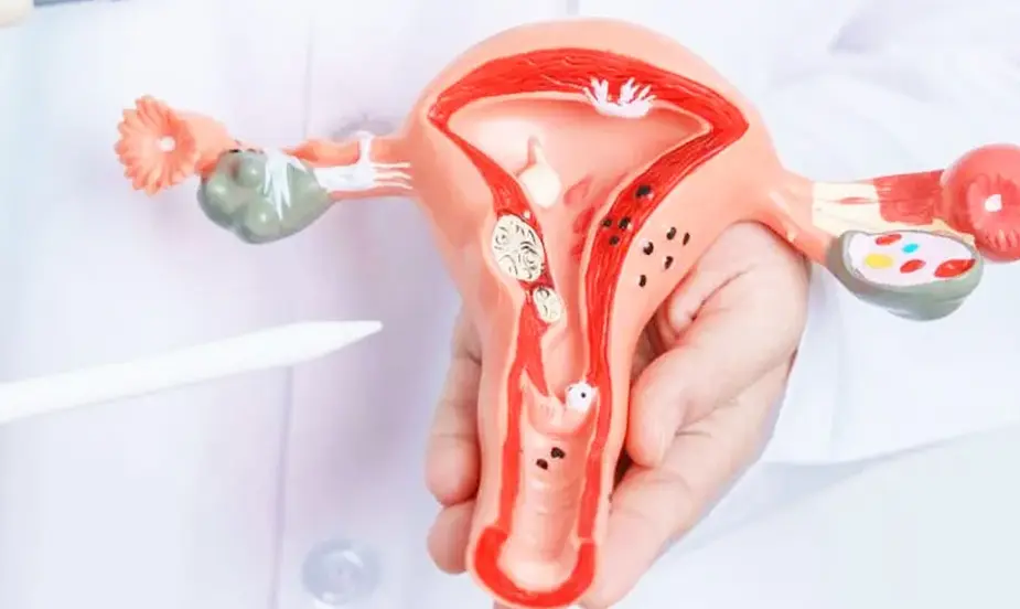 How to Prevent Ladies Problems?