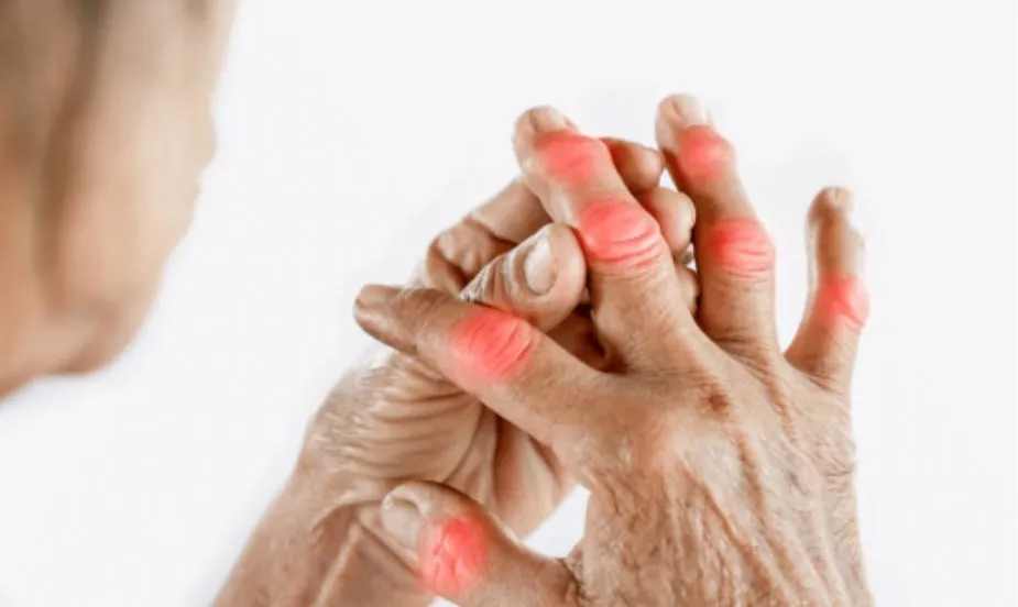 How to Prevent Arthritis?