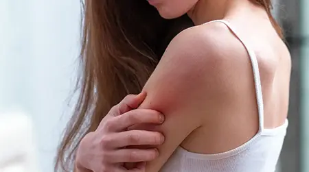 Avoid Scratching:  Prevents skin damage infection