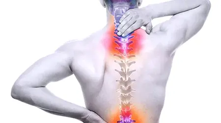 Degenerative Disc Disease