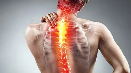 Posture-related Pain