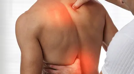 Upper Back Pain